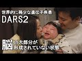 【稀少すぎる遺伝子疾患】脳にしわがない娘をケアする夫婦の葛藤 supported by にしたんARTクリニック #にしたんARTクリニック #ジャパンバリアフリープロジェクト #障害 #障がい