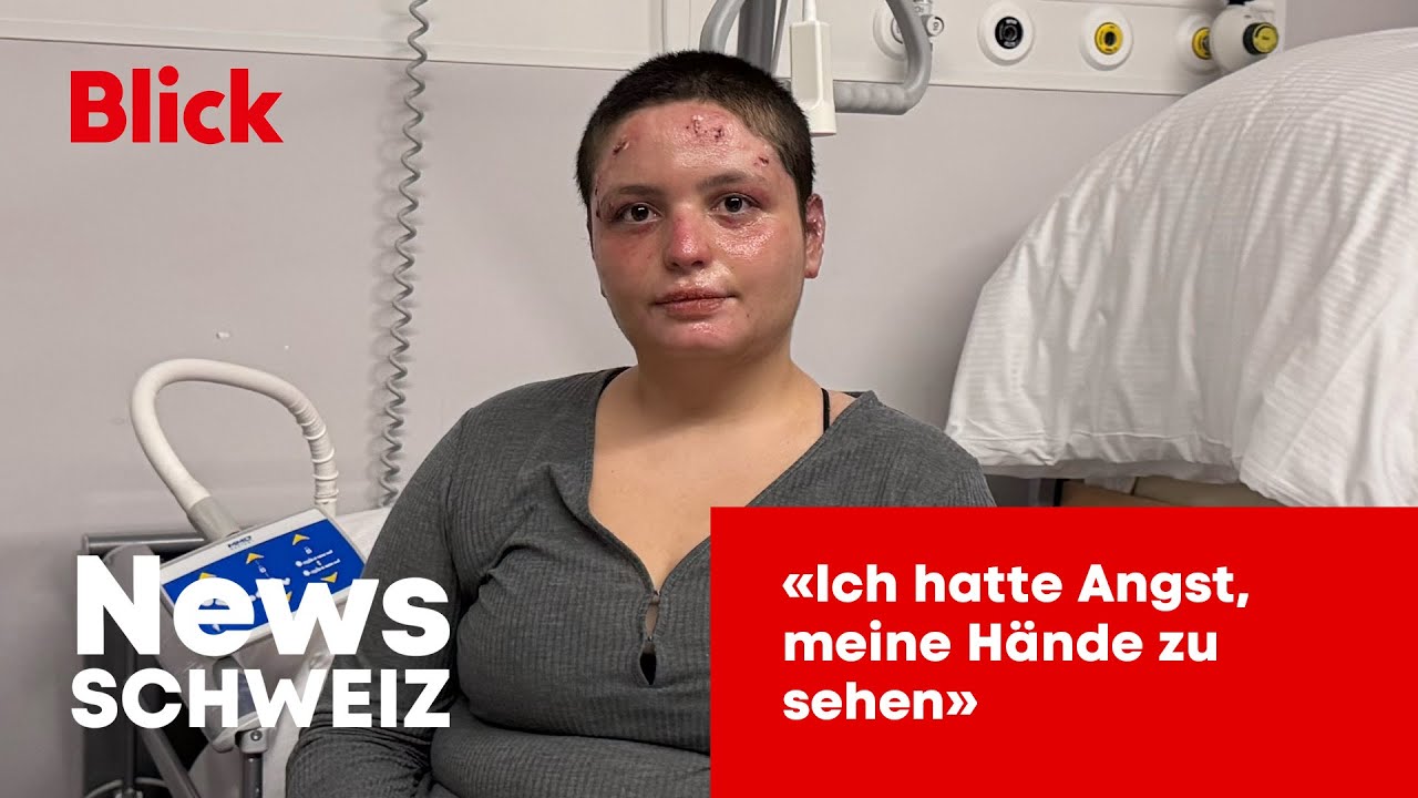 Blick trifft Brandopfer Roze (18) im Spital in Morges VD