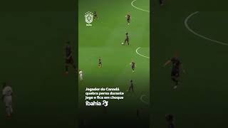 Jogador do Canadá quebra perna durante jogo e fica em choque