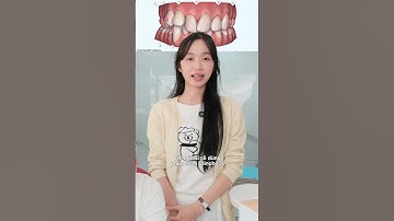 Niềng răng trong suốt và top 5 câu hỏi phải hỏi bác sĩ #elitedental #nhakhoa #niengrang