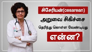சிசேரியன்(cesarean) அறுவை சிகிச்சை தெரிந்து கொள்ள வேண்டியது என்ன | Dr S M SreDevi | Tamil