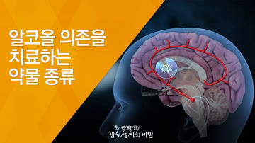 알코올 의존을 치료하는 약물 종류 - (2009.10.22_444회 방송)_금단 증상을 극복하라 - 2편 알코올