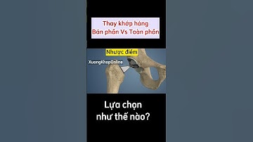 Thay khớp háng bán phần, chỉ định khi nào?