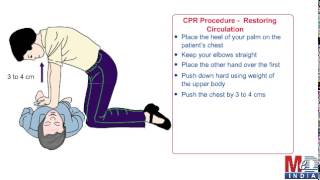 Cardiopulmonary Resuscitation Cpr