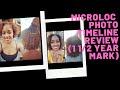 1 1\2 Year Microloc Journey Photo Timeline| Fine Hair| Loc Changes