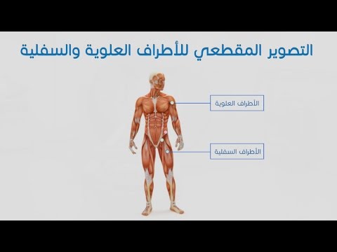 التصوير المقطعي للأطراف العلوية والسفلية