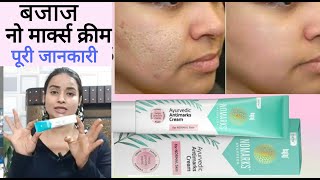 *New* Bajaj Nomarks Cream For Normal Skin | Remove Acne | Pimples | dark spots | Blemish|Full Review