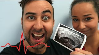 I HEARD OUR BABYS HEARTBEAT!!!