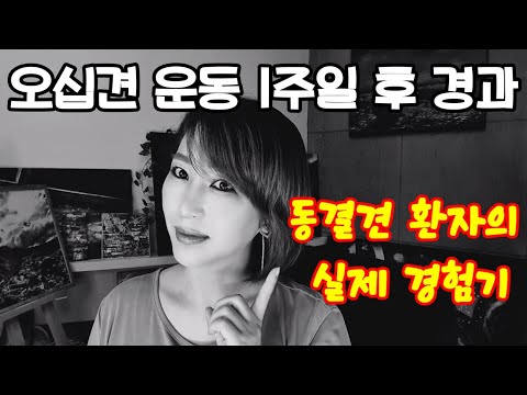 오십견(동결견) 환자가 보여주는 운동법 1주차 기록