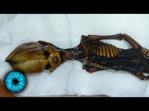 Video: Das Geheimnis Der Länglichen Schädel Von Paracas. Mensch Oder Alien? - Alternative Ansicht