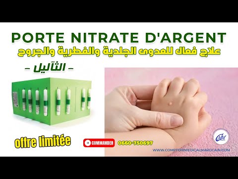     كيفية استخدام نترات الفضة للتخلص من الثآليل