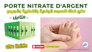 CRAYON NITRATE D’ARGENT#كيفية استخدام نترات الفضة للتخلص من الثآليل