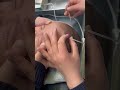 Intramuscular Injection Safely | Nurse-Level IM Injection Step-by-Step Training Guide Class No. 11
