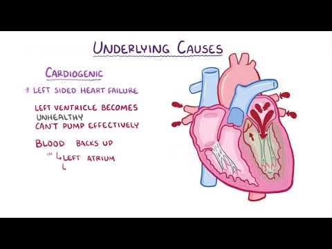 Video: Edema Periferal: Apakah Itu, Gejala Dan Sebabnya