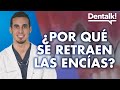 Encías retraídas: preguntas frecuentes sobre la recesión gingival - Dentalk! ©