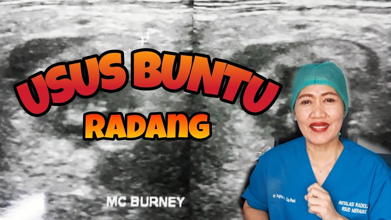 Penyebab dan gejala klinis radang usus buntu - YouTube