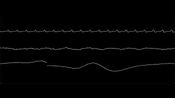 Processing Audio Visual Interaction Experiment - Yunlong Li / Unit 7