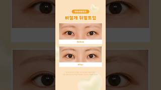 Fit me 트임 ~ 👀💛#뒤트임 #밑트임 #뒤밑트임 #트임