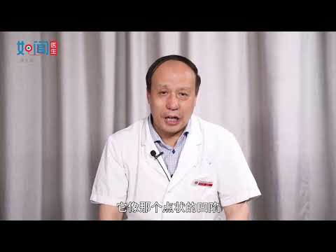 【皮肤科】手指甲凹陷是怎么回事