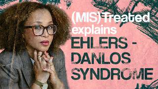 Full What is Ehlers-Danlos Syndrome | (MIS)Treated Explains News
