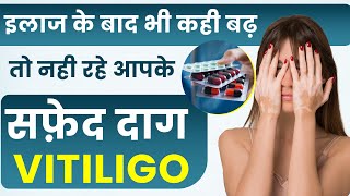 सफ़ेद दाग क्यों होते है| Sing & Symptoms of Vitiligo | Safed Daag Ka Ilaaj