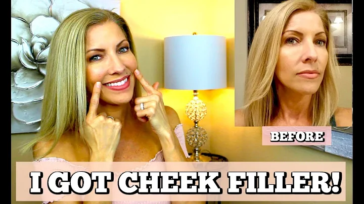 I Got Cheek Filler! + Rant to Critics ~ Over 40 (4...