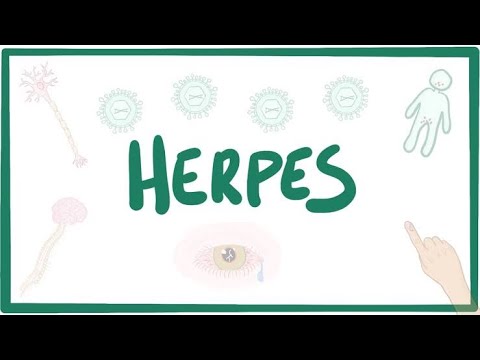 اقوي وارخص علاج لفيروس الهيربس نهائيااا Herpes