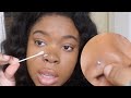 To Get Rid Of A Nose Piercing Bump FAST! (KELOID)