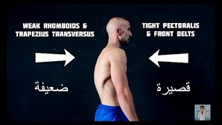 تمارين لعلاج الاتب (تقوس او انحناء الظهر) عالج نفسك فى البيت  -Kyphosis therapy