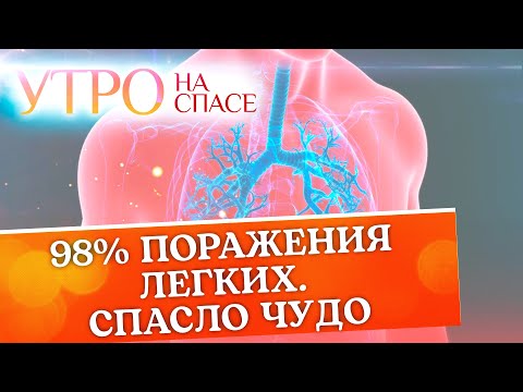 98% ПОРАЖЕНИЯ ЛЕГКИХ. СПАСЛО ЧУДО