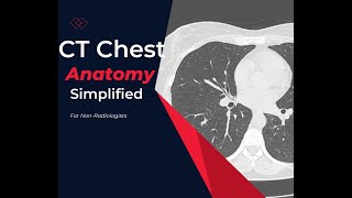 CT chest Anatomy Made simple- For Medical students, residents and clinicians