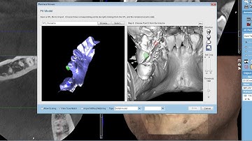 Fitting dental models with CBCT