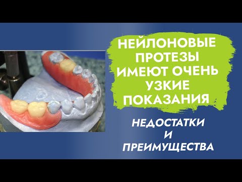 Нейлоновые протезы. Эластичные, гибкие зубные протезы. Квадротти.