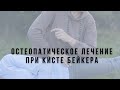 Остеопатия при кисте Бейкера. Случай из практики.