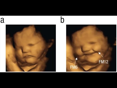 Fetuses in the womb smiled after their mothers ate carrots but scowled over kale, research says