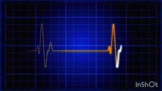 An electrocardiogram heart monitor pulses on a blue grid screenshot 4