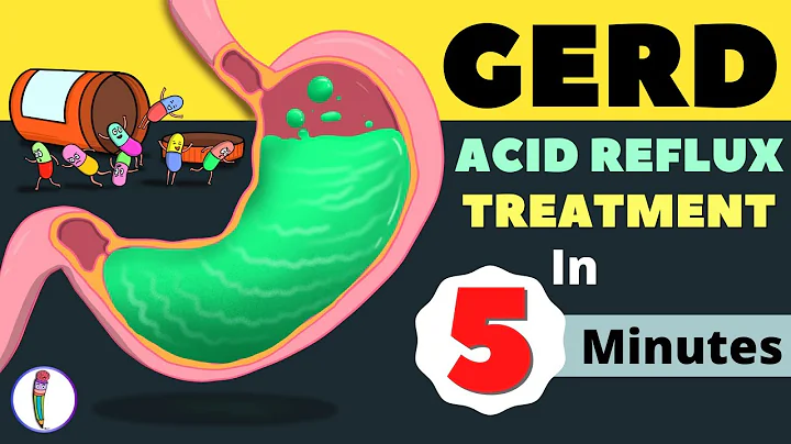 GERD Treatment | Acid Reflux Treatment | Heartburn Treatment - All You Need to Know - DayDayNews