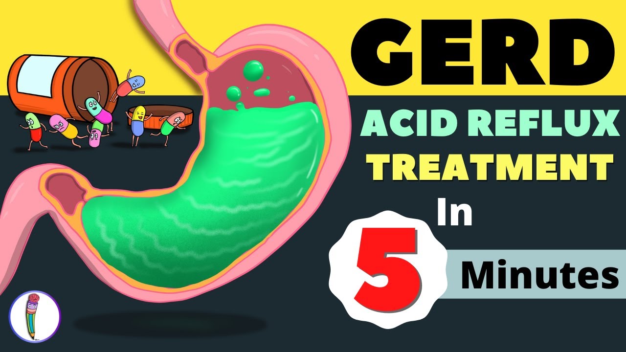 How Should We Treat GERD Associated With a Chronic Cough?