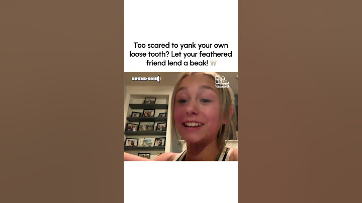Hilarious Parrot Helps Girl Pull Tooth Out!