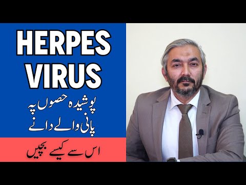 Herpes Simplex Virus In Urdu- Herpes Ki Alamat Ilaj - Herpes Symptoms & Treatment - Genital Herpes