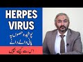 Herpes simplex virus in urdu herpes ki alamat ilaj  herpes symptoms  treatment  genital herpes