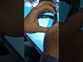 Vivo V11  Pro Screen damage  #ytshorts #mobile #iphones #device #vivo #display #combo #folder