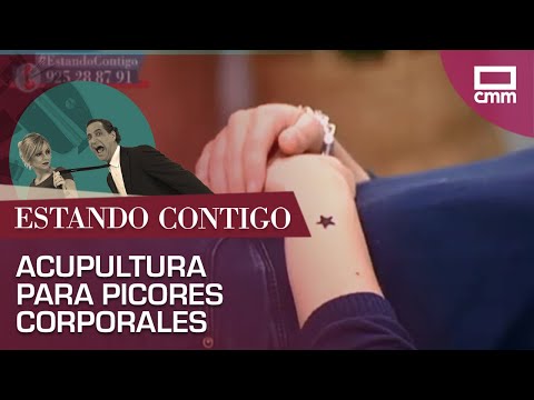 Acupuntura para mejorar los picores corporales | Estando Contigo