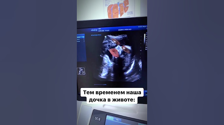 Девочки а вы  сколько набрали за беременность ?)