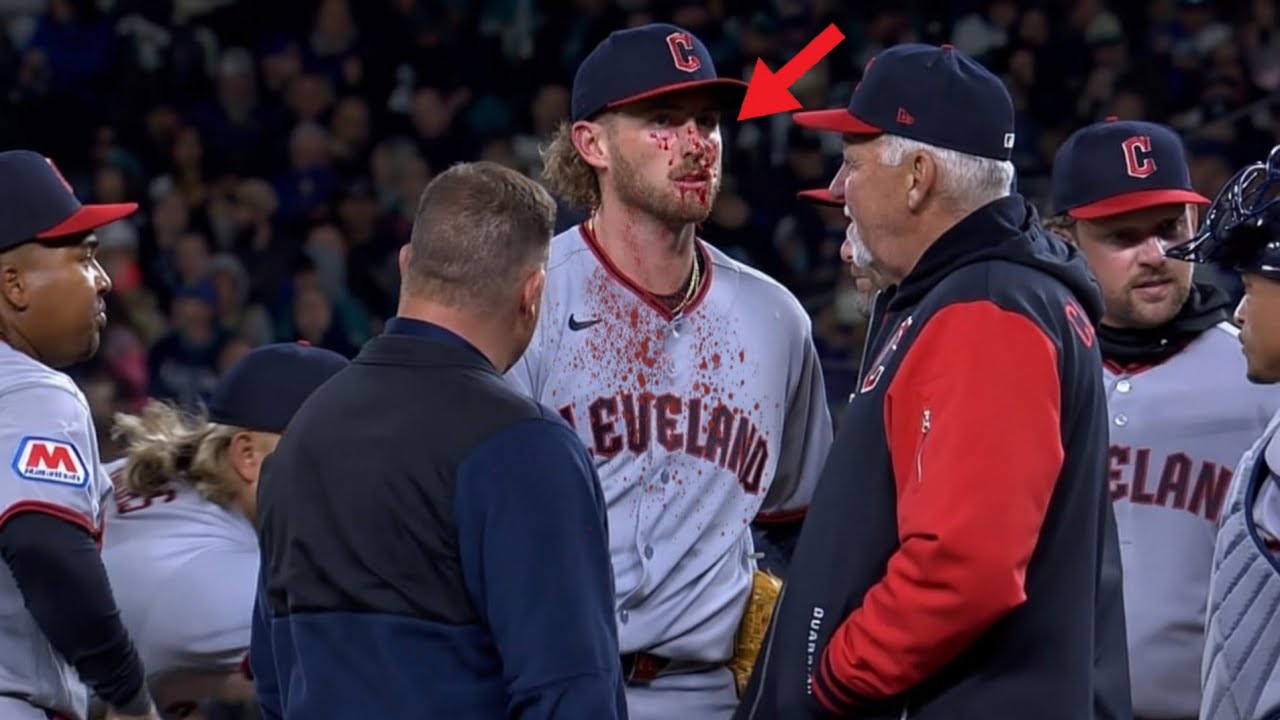 Injuries In Baseball Compilation / MLB 5 - YouTube