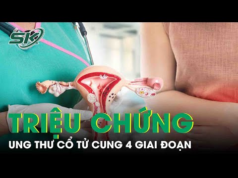 Video: Làm thế nào để nhận biết các triệu chứng ung thư tử cung: 11 bước (có hình ảnh)