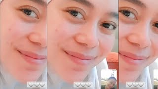 Baru saja, photo terbaru bunda Lesti tersenyum, bikin tenang kita semua Masya Allah, - teh rossa