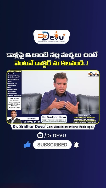 treatment-for-black-spots-on-legs-varicose-veins-symptoms-dr-devu