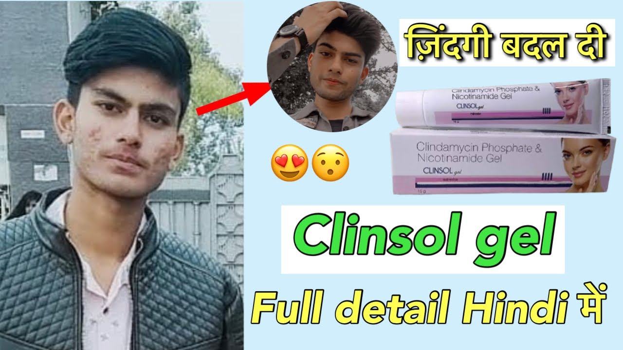Clinsol gel || clinsol gel review in hindi ||clindamysin phosphate ||