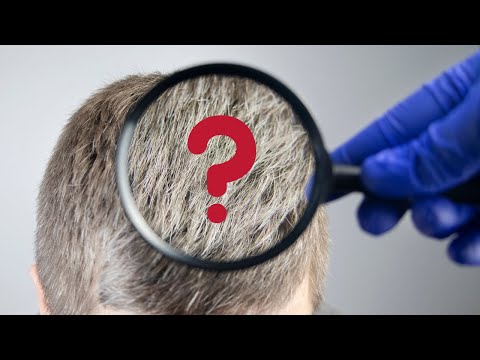 Videó: Mi okozza a hajszálakat?